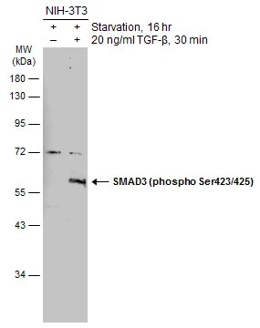 Untreated (–) and treated (+) NIH-3T3 whole cell extracts (30 μg) were separated by 10% SDS-PAGE, and the membrane was blotted with SMAD3 (phospho Ser423/425) antibody (GTX129841) diluted at 1:500. The HRP-conjugated anti-rabbit IgG antibody (GTX213110-01) was used to detect the primary antibody.