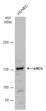Whole cell extract (30 ug) was separated by 5% SDS-PAGE,and the membrane was blotted with eNOS antibody (GTX129843) diluted at 1:500. The HRP-conjugated anti-rabbit IgG antibody (GTX213110-01) was used to detect the primary antibody.