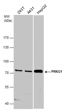 Various whole cell extracts (30 μg) were separated by 7.5% SDS-PAGE, and the membrane was blotted with PRKG1 antibody (GTX129845) diluted at 1:1000.