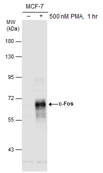 Anti-c-Fos antibody (GTX129846) | GeneTex
