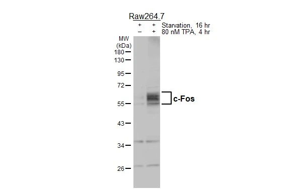 Anti-c-Fos antibody (GTX129846) | GeneTex