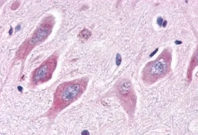IHC-P analysis of brain hippocampus neurons tissue using GTX12985 ERR alpha antibody. IHC-P analysis of brain hippocampus neurons tissue using GTX12985 ERR alpha antibody.