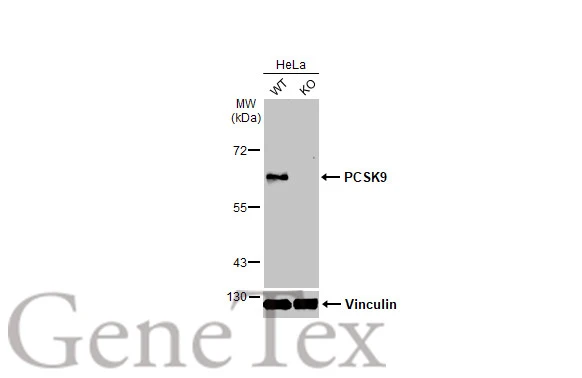 Wild-type (WT) and PCSK9 knockout (KO) HeLa cell extracts (30 μg) were separated by 7.5% SDS-PAGE, and the membrane was blotted with PCSK9 antibody (GTX129859) diluted at 1:500. The HRP-conjugated anti-rabbit IgG antibody (GTX213110-01) was used to detect the primary antibody.