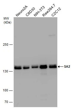 Various whole cell extracts (50 μg) were separated by 5% SDS-PAGE, and the membrane was blotted with SA2 antibody (GTX129876) diluted at 1:1000. Various whole cell extracts (50 μg) were separated by 5% SDS-PAGE, and the membrane was blotted with SA2 antibody (GTX129876) diluted at 1:1000.