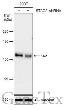 Non-transfected (–) and transfected (+) 293T whole cell extracts (30 μg) were separated by 5% SDS-PAGE, and the membrane was blotted with SA2 antibody (GTX129876) diluted at 1:2000. Non-transfected (–) and transfected (+) 293T whole cell extracts (30 μg) were separated by 5% SDS-PAGE, and the membrane was blotted with SA2 antibody (GTX129876) diluted at 1:2000.