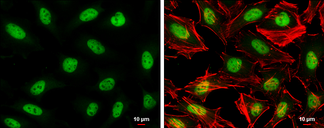 SA2 antibody detects SA2 protein at nucleus by immunofluorescent analysis. Sample: HeLa cells were fixed in 4% paraformaldehyde at RT for 15 min. Green: SA2 stained by SA2 antibody (GTX129876) diluted at 1:500. Red: phalloidin, a cytoskeleton marker, diluted at 1:100. Scale bar= 10μm. SA2 antibody detects SA2 protein at nucleus by immunofluorescent analysis. Sample: HeLa cells were fixed in 4% paraformaldehyde at RT for 15 min. Green: SA2 stained by SA2 antibody (GTX129876) diluted at 1:500. Red: phalloidin, a cytoskeleton marker, diluted at 1:100. Scale bar= 10μm.