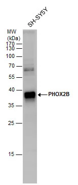 PHOX2B antibody detects PHOX2B protein by western blot analysis. Whole cell extracts (30 μg) was separated by 12% SDS-PAGE, and the membrane was blotted with PHOX2B antibody (GTX129908) diluted by 1:1000.