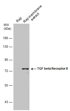 Raji whole cell and membrane extracts (30 μg) were separated by 7.5% SDS-PAGE, and the membrane was blotted with TGF beta Receptor II antibody (GTX129909) diluted at 1:500.