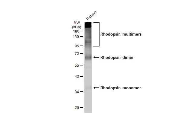 Rat tissue extract (50 μg) was separated by 10% SDS-PAGE, and the membrane was blotted with Rhodopsin antibody (GTX129910) diluted at 1:1000. The HRP-conjugated anti-rabbit IgG antibody (GTX213110-01) was used to detect the primary antibody. Corresponding RNA expression data for the same cell lines are based on Human Protein Atlas program.