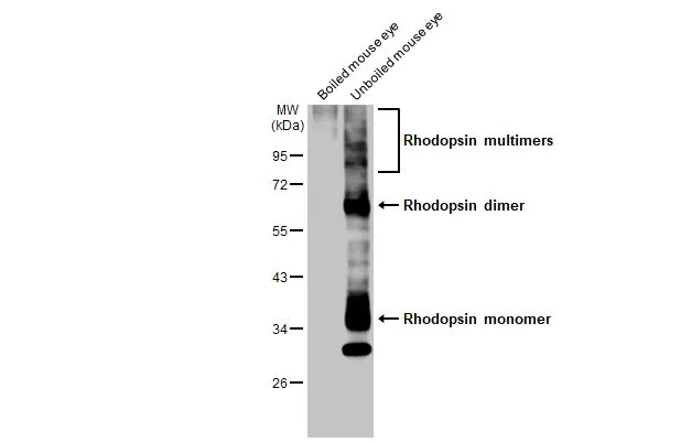 Boiled and unboiled mouse tissue extract (50 μg) were separated by 10% SDS-PAGE, and the membrane was blotted with Rhodopsin antibody (GTX129910) diluted at 1:2000. The HRP-conjugated anti-rabbit IgG antibody (GTX213110-01) was used to detect the primary antibody.