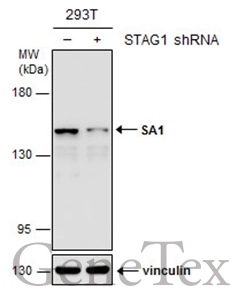 Non-transfected (–) and transfected (+) 293T whole cell extracts (30 μg) were separated by 5% SDS-PAGE, and the membrane was blotted with SA1 antibody (GTX129912) diluted at 1:5000. The HRP-conjugated anti-rabbit IgG antibody (GTX213110-01) was used to detect the primary antibody. Non-transfected (–) and transfected (+) 293T whole cell extracts (30 μg) were separated by 5% SDS-PAGE, and the membrane was blotted with SA1 antibody (GTX129912) diluted at 1:5000. The HRP-conjugated anti-rabbit IgG antibody (GTX213110-01) was used to detect the primary antibody.