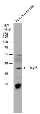 Myf5 antibody detects Myf5 protein by western blot analysis. Human tissue extracts (30 μg) was separated by 12 % SDS-PAGE, and the membrane was blotted with Myf5 antibody (GTX129925) diluted by 1:1000.