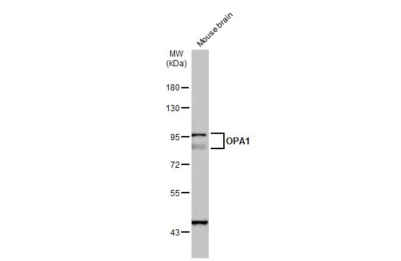Mouse tissue extract (50 μg) was separated by 10% SDS-PAGE, and the membrane was blotted with OPA1 antibody (GTX129952) diluted at 1:500. The HRP-conjugated anti-rabbit IgG antibody (GTX213110-01) was used to detect the primary antibody.