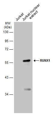 Jurkat whole cell and nuclear extracts (60 μg) were separated by 10% SDS-PAGE, and the membrane was blotted with RUNX1 antibody (GTX129953) diluted at 1:1000. The HRP-conjugated anti-rabbit IgG antibody (GTX213110-01) was used to detect the primary antibody.