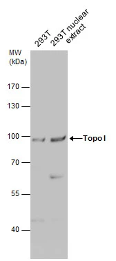 293T whole cell and nuclear extracts (30 ug) were separated by 7.5% SDS-PAGE,and the membrane was blotted with Topo I antibody (GTX129960) diluted at 1:500.