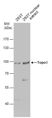 293T whole cell and nuclear extracts (30 μg) were separated by 7.5% SDS-PAGE, and the membrane was blotted with Topo I antibody (GTX129960) diluted at 1:500.