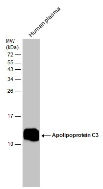 Human tissue extract (30 μg) was separated by 15% SDS-PAGE, and the membrane was blotted with Apolipoprotein C3 antibody (GTX129994) diluted at 1:10000.