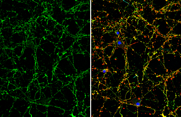 VIP antibody detects VIP protein by immunofluorescent analysis. Sample: DIV10 rat E18 primary cortical neuron cells were fixed in 4% paraformaldehyde at RT for 15 min. Green: VIP stained by VIP antibody (GTX129997) diluted at 1:500. Red: beta Tubulin 3/ Tuj1, stained by beta Tubulin 3/ Tuj1 antibody [GT11710] (GTX631836) diluted at 1:500. Blue: Fluoroshield with DAPI (GTX30920).