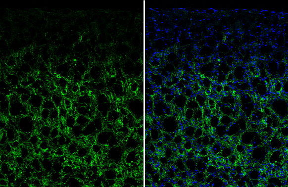 VIP antibody