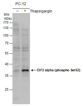 eIF2 alpha (phospho Ser51) antibody