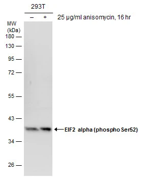 eIF2 alpha (phospho Ser51) antibody