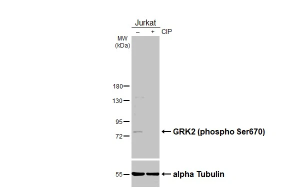 Untreated (–) and treated (+) Jurkat whole cell extracts (30 μg) were separated by 7.5% SDS-PAGE, and the membrane was blotted with GRK2 (phospho Ser670) antibody (GTX130007) diluted at 1:1000. The HRP-conjugated anti-rabbit IgG antibody (GTX213110-01) was used to detect the primary antibody.