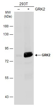Non-transfected (–) and transfected (+) 293T whole cell extracts (30 μg) were separated by 7.5% SDS-PAGE, and the membrane was blotted with GRK2 antibody (GTX130012) diluted at 1:1000. The HRP-conjugated anti-rabbit IgG antibody (GTX213110-01) was used to detect the primary antibody.