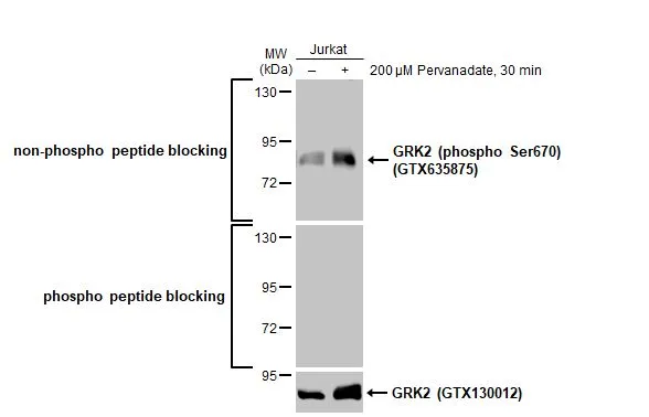 Untreated (–) and treated (+) Jurkat whole cell extracts (30 μg) were separated by 7.5% SDS-PAGE, and the membrane was blotted with GRK2 antibody (GTX130012) diluted at 1:1000. The HRP-conjugated anti-rabbit IgG antibody (GTX213110-01) was used to detect the primary antibody, and the signal was developed with Trident ECL plus-Enhanced.
