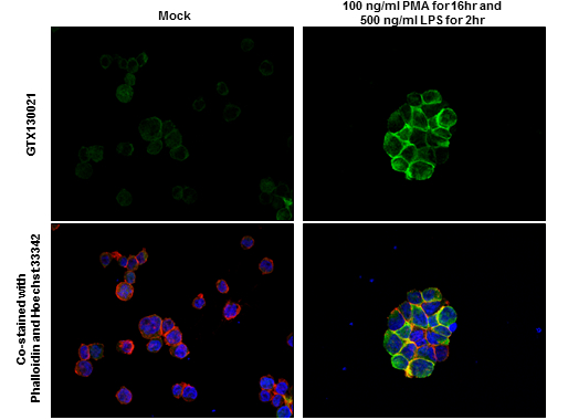 IL1 beta antibody detects IL1 beta protein by immunofluorescent analysis. Sample: Mock and treated THP-1 cells were fixed in 4% paraformaldehyde at RT for 15 min. Green: IL1 beta stained by IL1 beta antibody (GTX130021) diluted at 1:500. Red: phalloidin, a cytoskeleton marker, diluted at 1:100. Blue: Fluoroshield with DAPI (GTX30920).
