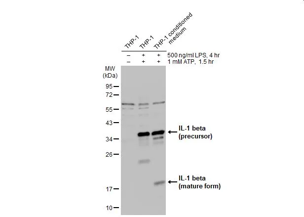 IL1 beta antibody