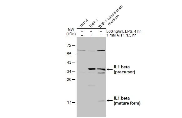 激レア TISA PHENOMENON HOODリング 激レア TISA PHENOMENON HOODリング