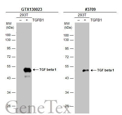 Various whole cell extracts (30 ug) were separated by 10% SDS-PAGE,and the membranes were blotted with TGF beta 1 antibody (GTX130023) diluted at 1:500 and competitor's antibody (CST#3709) diluted at 1:500.