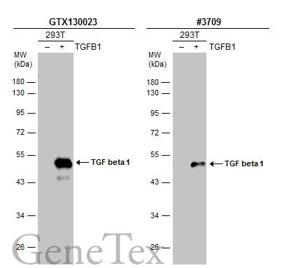 Non-transfected (–) and transfected (+) 293T whole cell extracts (30 μg) were separated by 10% SDS-PAGE, and the membranes were blotted with TGF beta 1 antibody (GTX130023) diluted at 1:500 and competitor's antibody (#3709) diluted at 1:500. The HRP-conjugated anti-rabbit IgG antibody (GTX213110-01) was used to detect the primary antibody. *The competitor is not affiliated with GeneTex and does not endorse this product.