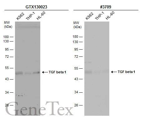 Various whole cell extracts (30 μg) were separated by 10% SDS-PAGE, and the membranes were blotted with TGF beta 1 antibody (GTX130023) diluted at 1:500 and competitor's antibody (CST#3709) diluted at 1:500. The HRP-conjugated anti-rabbit IgG antibody (GTX213110-01) was used to detect the primary antibody. *The competitor is not affiliated with GeneTex and does not endorse this product.