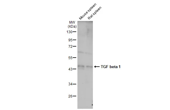 Various tissue extracts (50 μg) were separated by 10% SDS-PAGE, and the membrane was blotted with TGF beta 1 antibody (GTX130023) diluted at 1:1000. The HRP-conjugated anti-rabbit IgG antibody (GTX213110-01) was used to detect the primary antibody, and the signal was developed with Trident ECL plus-Enhanced.