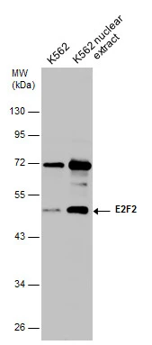 K562 whole cell and nuclear extracts (30 μg) were separated by 10% SDS-PAGE, and the membrane was blotted with E2F2 antibody (GTX130030) diluted at 1:500.