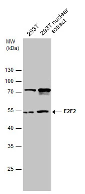 293T whole cell and nuclear extracts (30 μg) were separated by 10% SDS-PAGE, and the membrane was blotted with E2F2 antibody (GTX130030) diluted at 1:500.