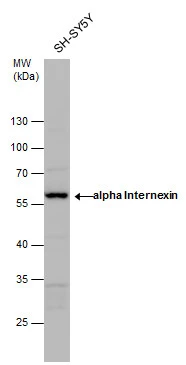 alpha Internexin antibody detects alpha Internexin protein by western blot analysis. Whole cell extracts (30 μg) was separated by 10% SDS-PAGE, and the membrane was blotted with alpha Internexin antibody (GTX130053) diluted by 1:1000. alpha Internexin antibody detects alpha Internexin protein by western blot analysis. Whole cell extracts (30 μg) was separated by 10% SDS-PAGE, and the membrane was blotted with alpha Internexin antibody (GTX130053) diluted by 1:1000.