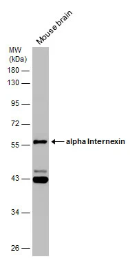 Mouse tissue extract (50 μg) was separated by 10% SDS-PAGE, and the membrane was blotted with alpha Internexin antibody (GTX130053) diluted at 1:1000. Mouse tissue extract (50 μg) was separated by 10% SDS-PAGE, and the membrane was blotted with alpha Internexin antibody (GTX130053) diluted at 1:1000.
