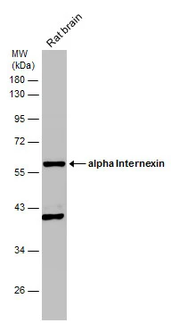 Rat tissue extract (50 μg) was separated by 10% SDS-PAGE, and the membrane was blotted with alpha Internexin antibody (GTX130053) diluted at 1:1000. Rat tissue extract (50 μg) was separated by 10% SDS-PAGE, and the membrane was blotted with alpha Internexin antibody (GTX130053) diluted at 1:1000.