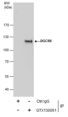 Immunoprecipitation of DGCR8 protein from Jurkat whole cell extracts using 5 ug of DGCR8 antibody (GTX130061). Western blot analysis was performed using DGCR8 antibody (GTX130061). EasyBlot anti-Rabbit IgG (GTX221666-01) was used as a secondary reagent.