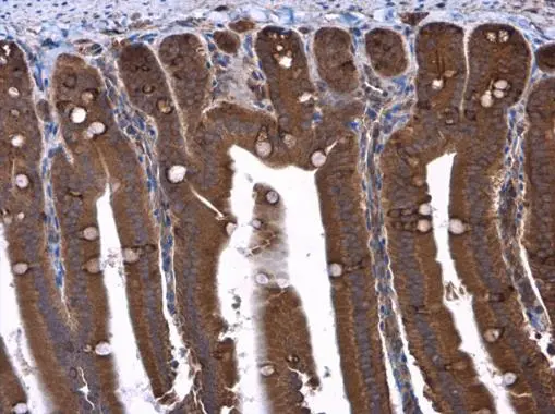 TSC1 antibody detects TSC1 protein at cytoplasm in mouse duodenum by immunohistochemical analysis. Sample: Paraffin-embedded mouse duodenum. TSC1 antibody (GTX130062) diluted at 1:500.
Antigen Retrieval: Citrate buffer, pH 6.0, 15 min TSC1 antibody detects TSC1 protein at cytoplasm in mouse duodenum by immunohistochemical analysis. Sample: Paraffin-embedded mouse duodenum. TSC1 antibody (GTX130062) diluted at 1:500.
Antigen Retrieval: Citrate buffer, pH 6.0, 15 min