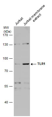 Jurkat whole cell and membrane extracts (30 μg) were separated by 7.5% SDS-PAGE, and the membrane was blotted with TLR1 antibody (GTX130079) diluted at 1:1000.