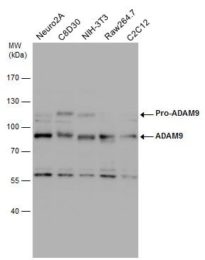 Various whole cell extracts (30 μg) were separated by 7.5% SDS-PAGE, and the membrane was blotted with ADAM9 antibody (GTX130081) diluted at 1:1000. Various whole cell extracts (30 μg) were separated by 7.5% SDS-PAGE, and the membrane was blotted with ADAM9 antibody (GTX130081) diluted at 1:1000.