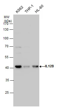 IL12B antibody detects IL12B protein by western blot analysis. Various whole cell extracts (30 ug) were separated by 10% SDS-PAGE,and the membrane was blotted with IL12B antibody (GTX130093) diluted by 1:2000.