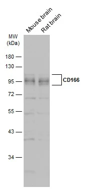 Various tissue extracts (50 μg) were separated by 10% SDS-PAGE, and the membrane was blotted with CD166 antibody (GTX130098) diluted at 1:1000. The HRP-conjugated anti-rabbit IgG antibody (GTX213110-01) was used to detect the primary antibody.