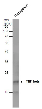 TNF beta antibody detects TNF beta protein by western blot analysis. Rat tissue extracts (30 μg) was separated by 12 % SDS-PAGE, and the membrane was blotted with TNF beta antibody (GTX130100) at a dilution of 1:500.