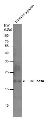 TNF beta antibody detects TNF beta protein by western blot analysis. Human tissue extracts (30 μg) was separated by 12% SDS-PAGE, and the membrane was blotted with TNF beta antibody (GTX130100) diluted at 1:500.