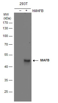 MAFB antibody detects MAFB protein by western blot analysis. Non-transfected (-) and MAFB-transfected (+, ) whole cell extracts (30 μg) were separated by 10% SDS-PAGE, and the membrane was blotted with MAFB antibody (GTX130107) at a dilution of 1:5000.