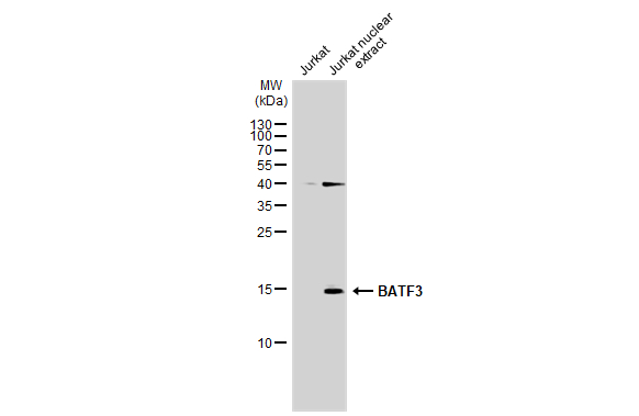 Jurkat whole cell and nuclear extracts (30 μg) were separated by 15% SDS-PAGE, and the membrane was blotted with BATF3 antibody (GTX130125) diluted at 1:1000. The HRP-conjugated anti-rabbit IgG antibody (GTX213110-01) was used to detect the primary antibody.